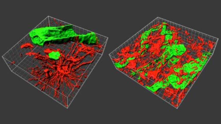 Recreació en 3D d'un Gliobastsoma | UAB