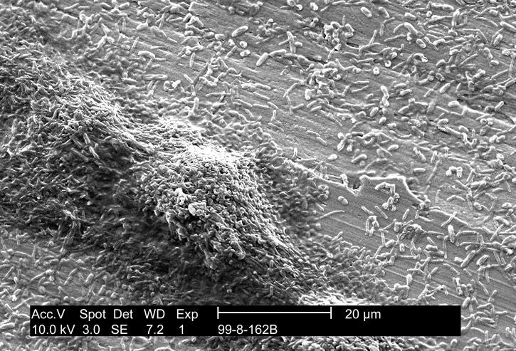 Legionel·la | Pixnio