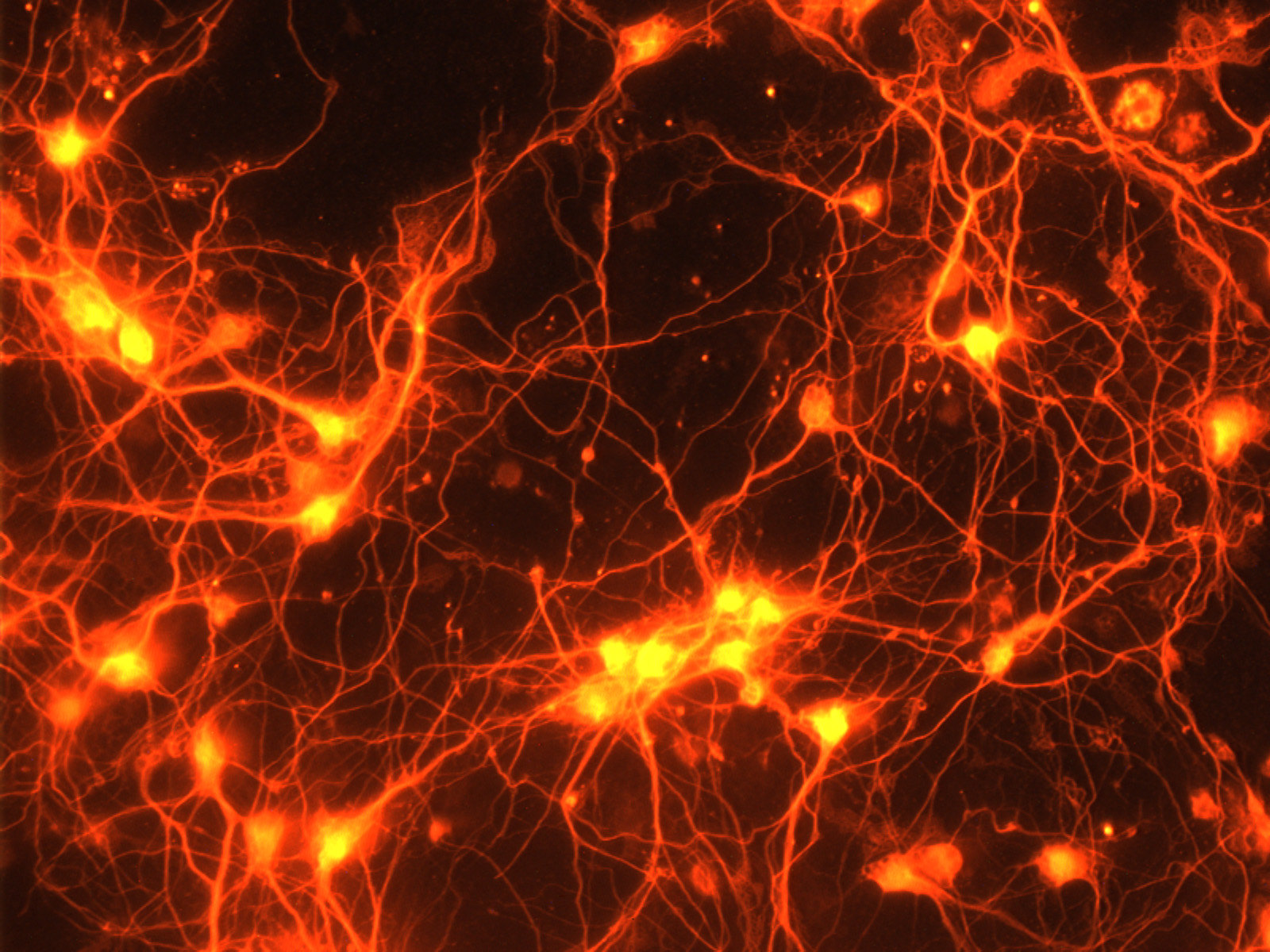 La distribució espacial de l'activitat de les neurones permet preveure quines ordres està donant al cos | NIH