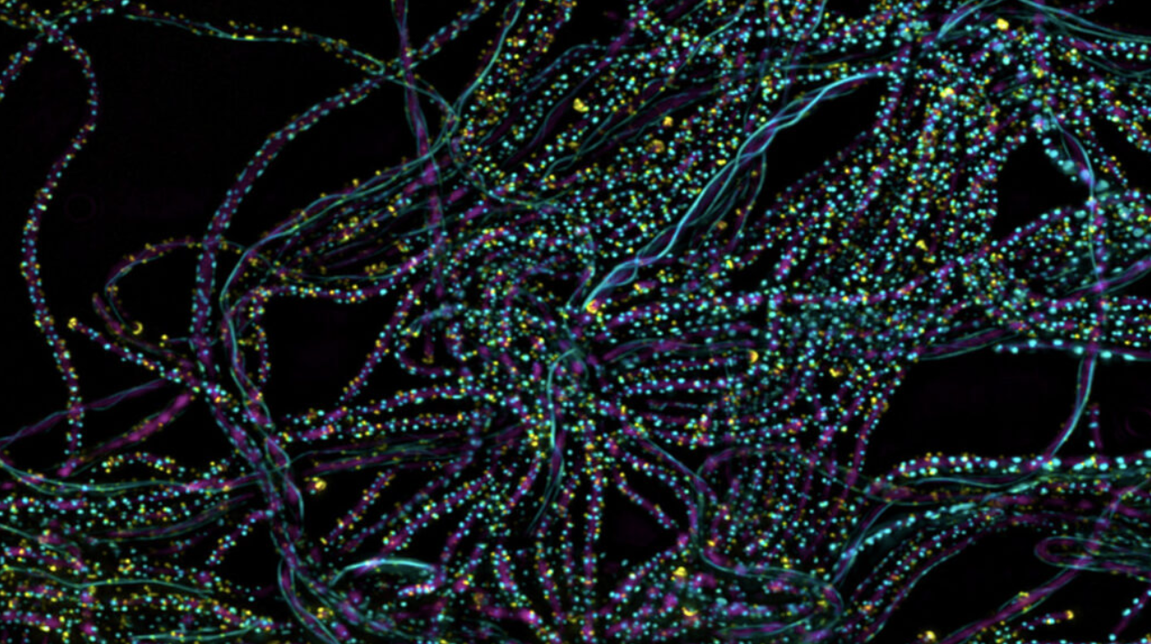Un experiment amb el bacteri 'Rhodobacter sphaeroides' ha permès veure que un sol fotó pot posar en marxa la fotosíntesi | Argonne National Laboratory (CC BY-NC-SA 2.0)