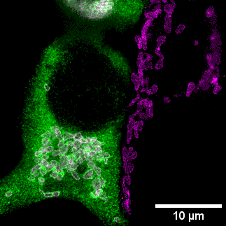 Imagen de superresolució con microscopia STED de células HEZ293 transfectadas con el transportador de zinc ZnT9 | Rubén Vicente