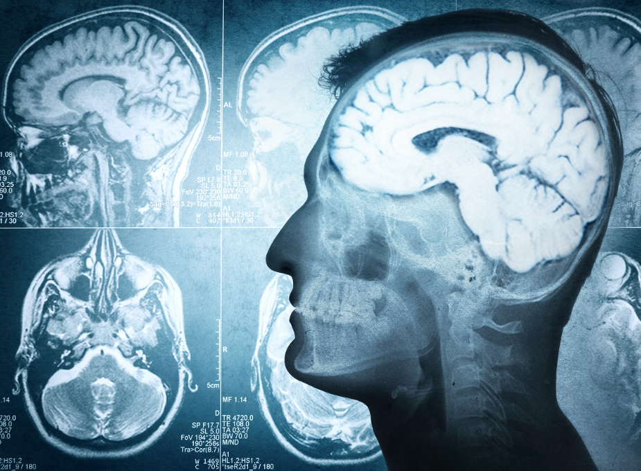 Els mecanismes de formació i assignació de valor al records són claus en alguns trastorns mentals | City University of Hong Kong