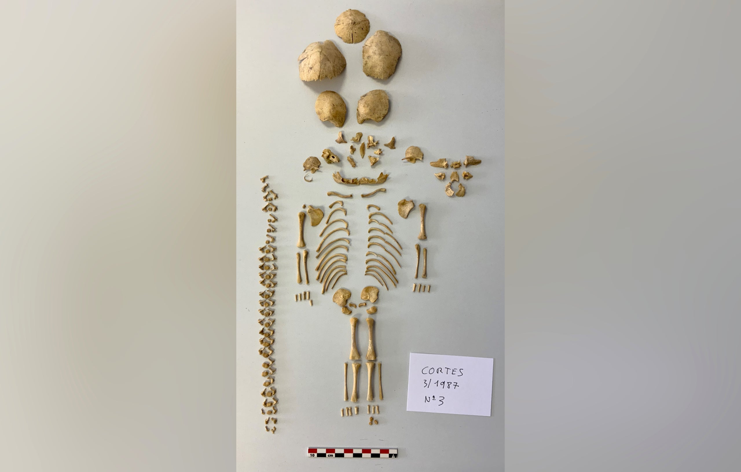 Esquelet d'una nena amb síndrome de Down que va morir al voltant de les 28 setmanes d'edat gestacional, descobert en un jaciment de l'Edat de Ferro de Navarra / ACN