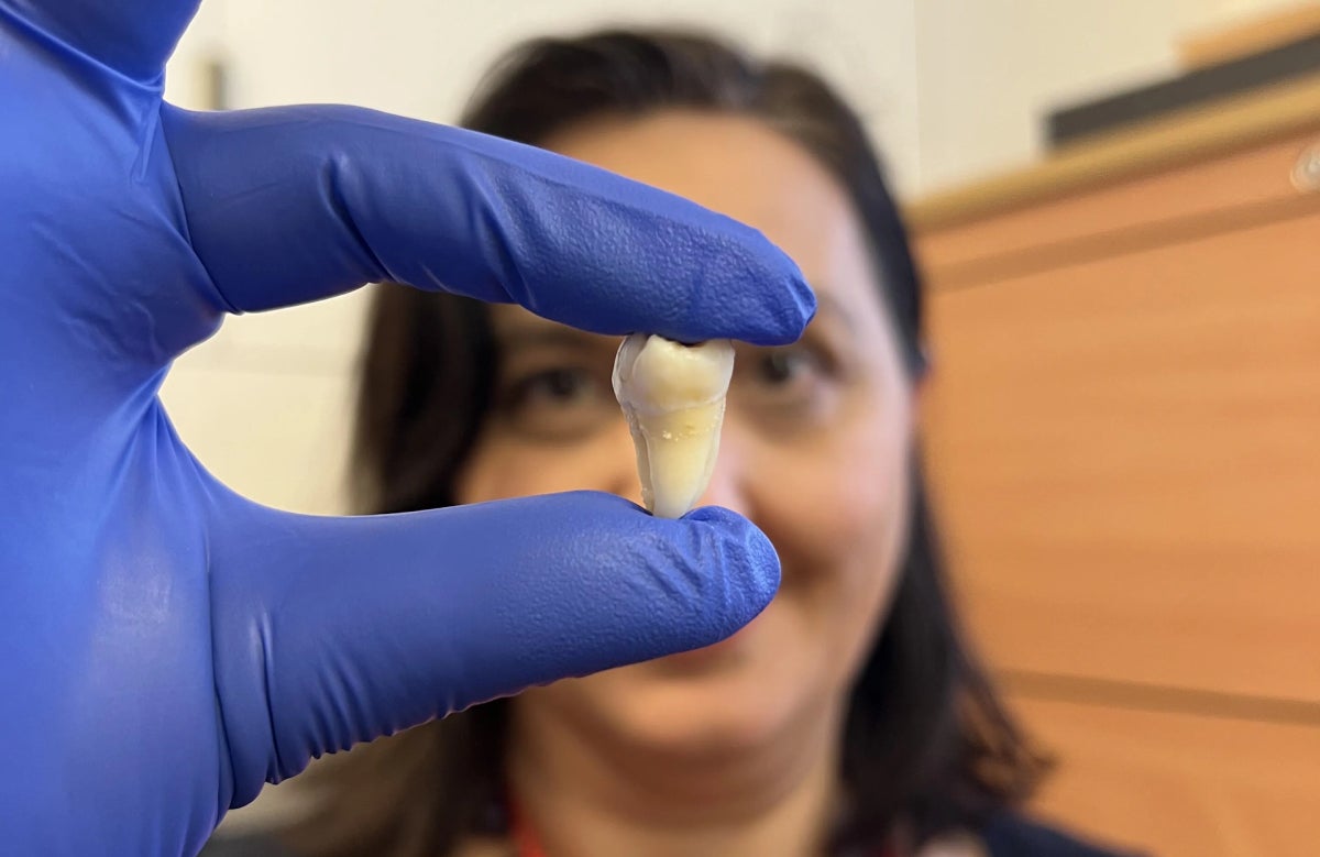 L'autora de l'estudi i membre del King's College London, la doctora Ana Angelova Volponi, posa amb la dent creada al laboratori | King's College London