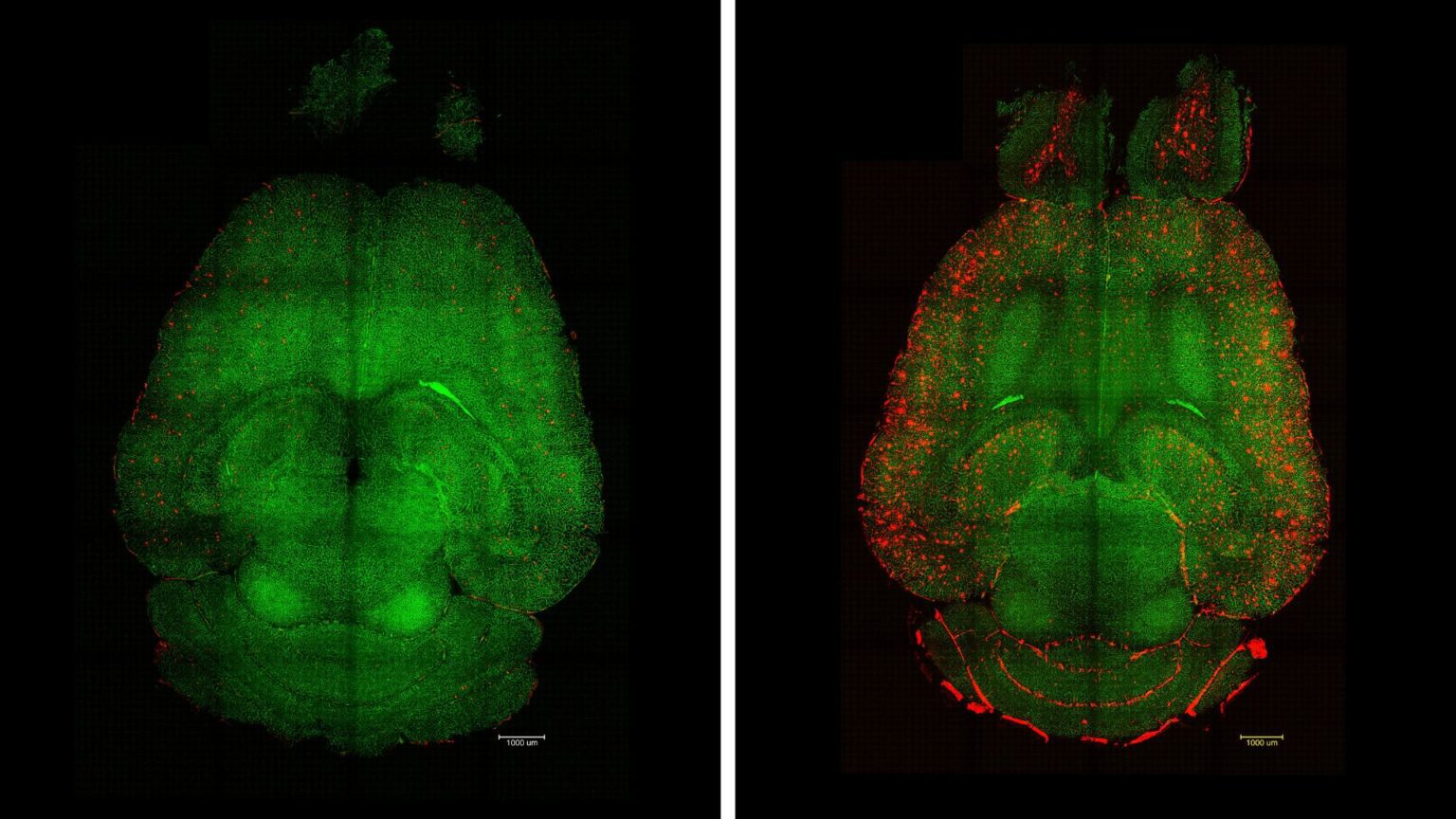 Imágenes de microscopía de fluorescencia basada en hoja de luz del cerebro de un ratón 12 horas después de haber sido tratado (izquierda) o no (derecha) con nanopartículas. Se analizaron los cerebros para ver la cantidad de acumulación de placas Aβ. Rojo: placas Aβ. Verde: vasos sanguíneos de la barrera hematoencefálica. | IBEC