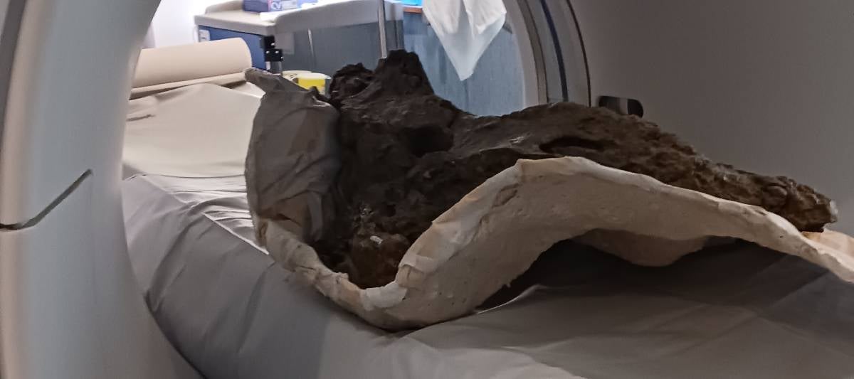 La vèrtebra de dinosaure a la que li han practicat un TAC a l'Hospital del Pallars | Cedida a l'ACN per l'Hospital del Pallars (ACN)